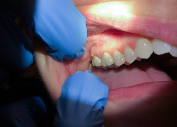 Best Emergency Broken Tooth Repair in Pittsburg, KS