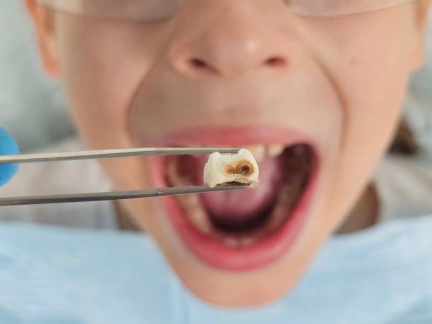 Best Walk-In Emergency Dentist in Pittsburg, KS